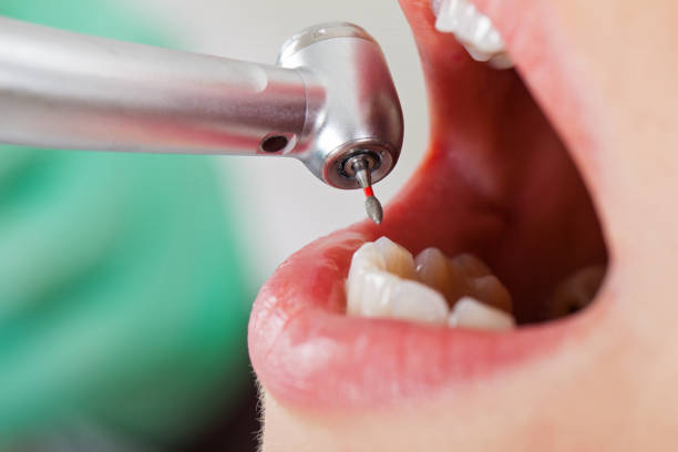 Best Emergency Treatment for Toothache in Tome, NM